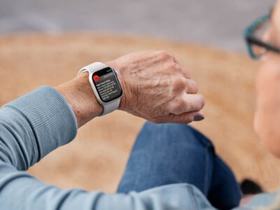 apple watch mgmt